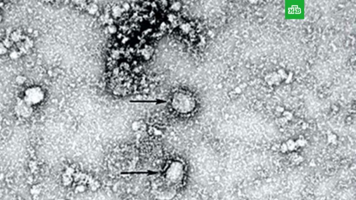 0корvirus.jpg